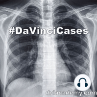 Chest Trauma Imaging [#DaVinciCases Pulmonary 2 - Anatomy Case 2]