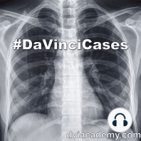 Pulmonary Embolism Pathology [#DaVinciCases Pulmonary 8 - Pathology Case 3]