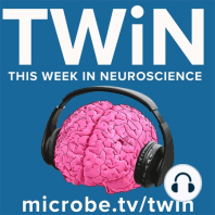 TWiN 50: Neurological sequelae after COVID-19