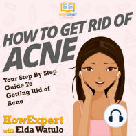 How To Get Rid of Acne