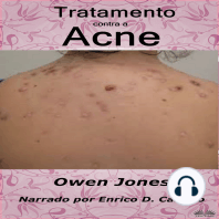 Tratamento contra a acne