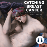Catching Breast Cancer