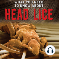 What You Need to Know about Head Lice