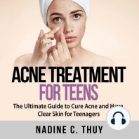 Acne Treatment for Teens