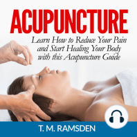 Acupuncture