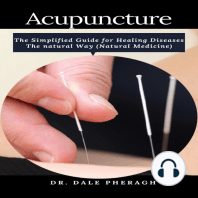 Acupuncture