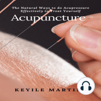 Acupuncture