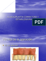 alveolotomiacorrectoraytoruspalatinolingual-120518114840-phpapp01