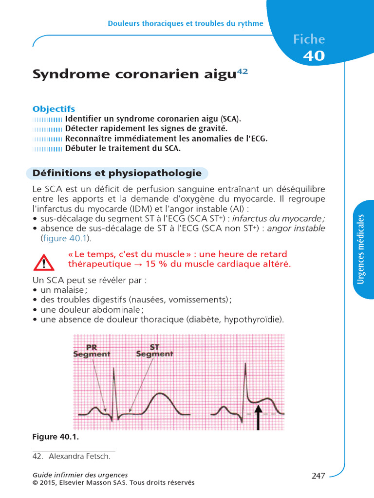 Fiche 40 Syndrome Coronarien Aigu | PDF | Infarctus du myocarde | Ischémie
