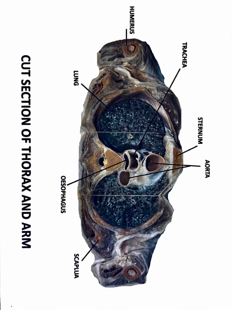 Thorax Dissection Atlas or Museum Chart | PDF