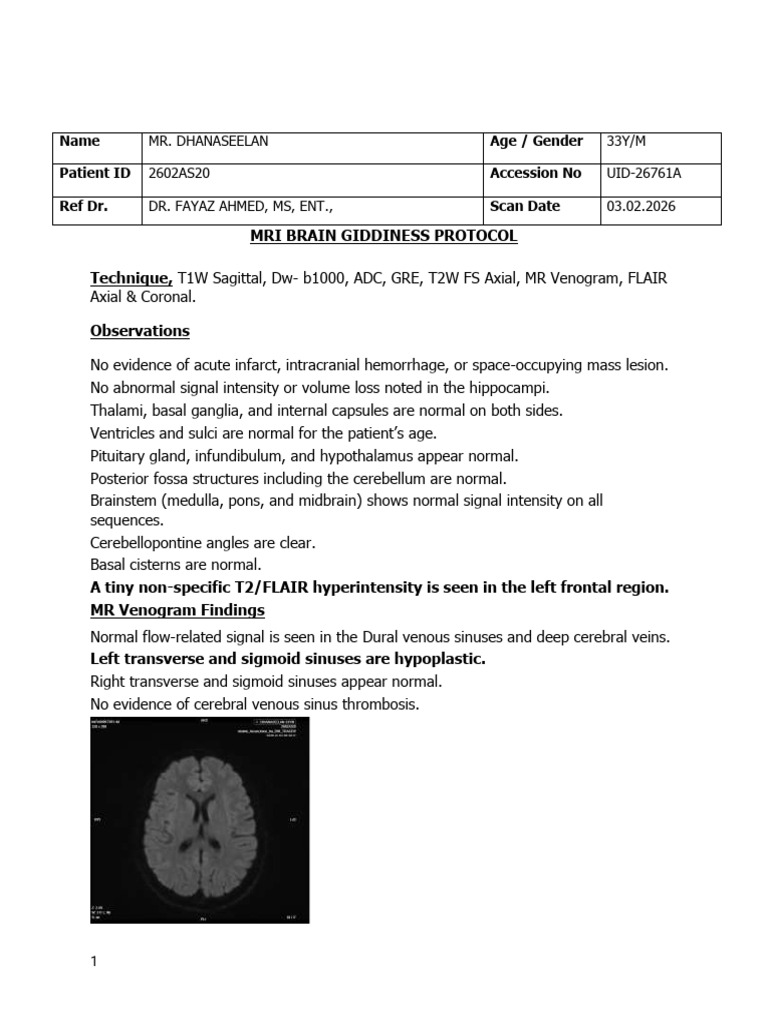 MR - Dhanaseelan 33y M Mri Brain Giddiness Protocol | PDF