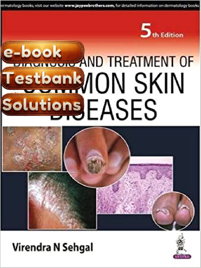 E-Book Testbank For Skin Disease Ebook Diagnosis and Treatment 3rd ...