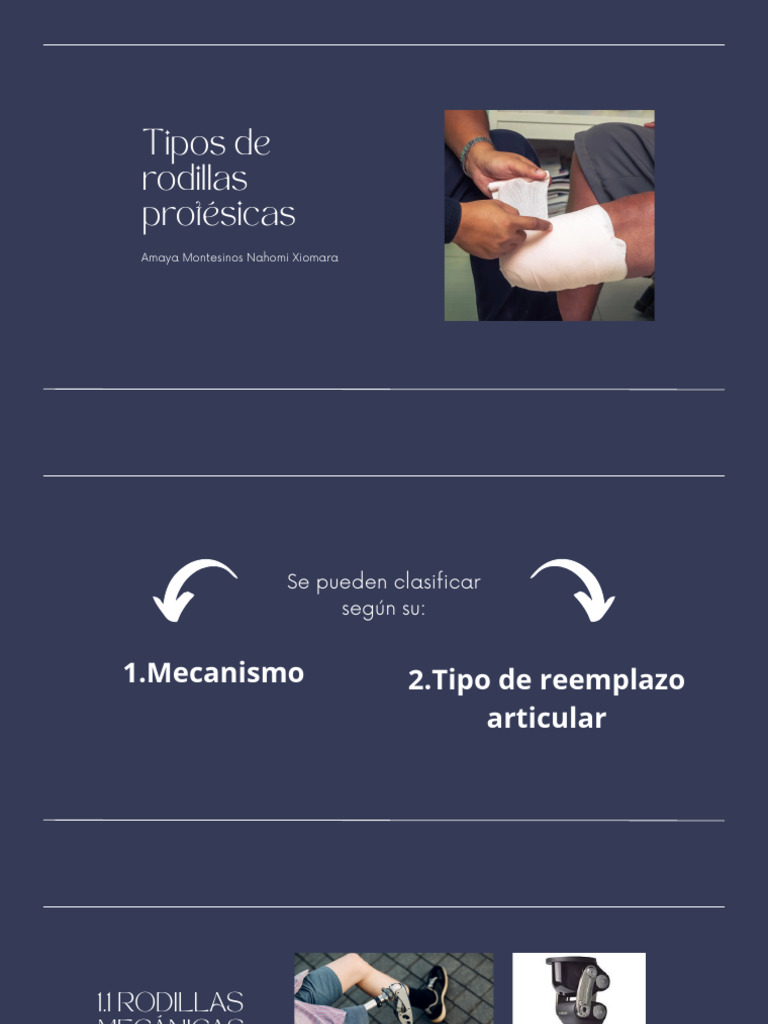 Tipos de Rodillas Protésicas | PDF | Rodilla