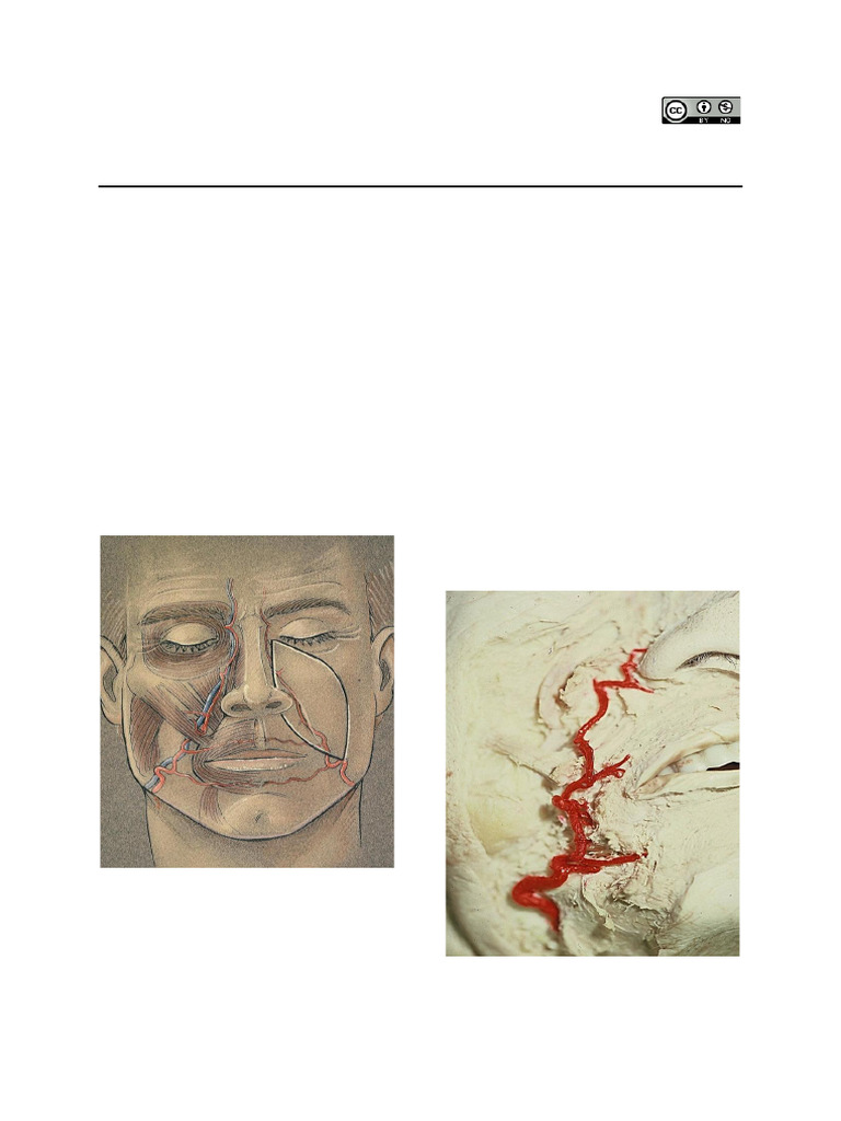 Nasolabial Flap For Oral Cavity Reconstruction | PDF ...