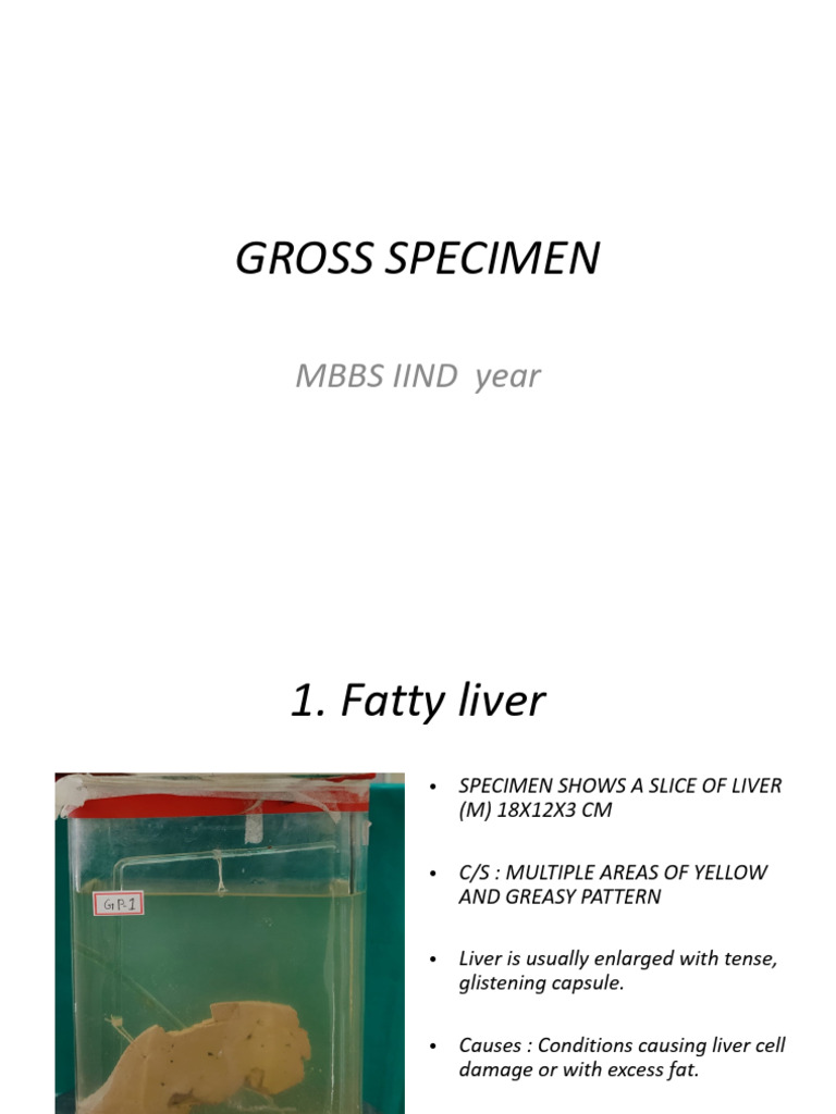 Gross Specimen Mbbs Iiyr | PDF | Neoplasms | Spleen