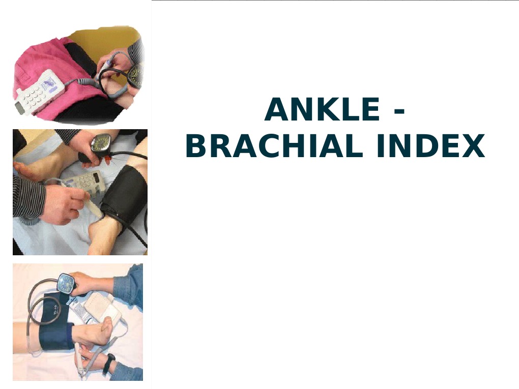 Ankle Brachial Index Pdf , Brachial Index (ABI) Measuring and ...
