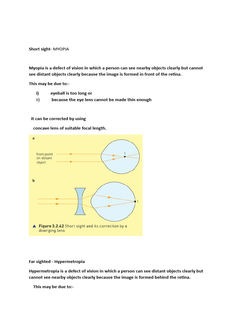 Short Sighted and Far Sighted | PDF