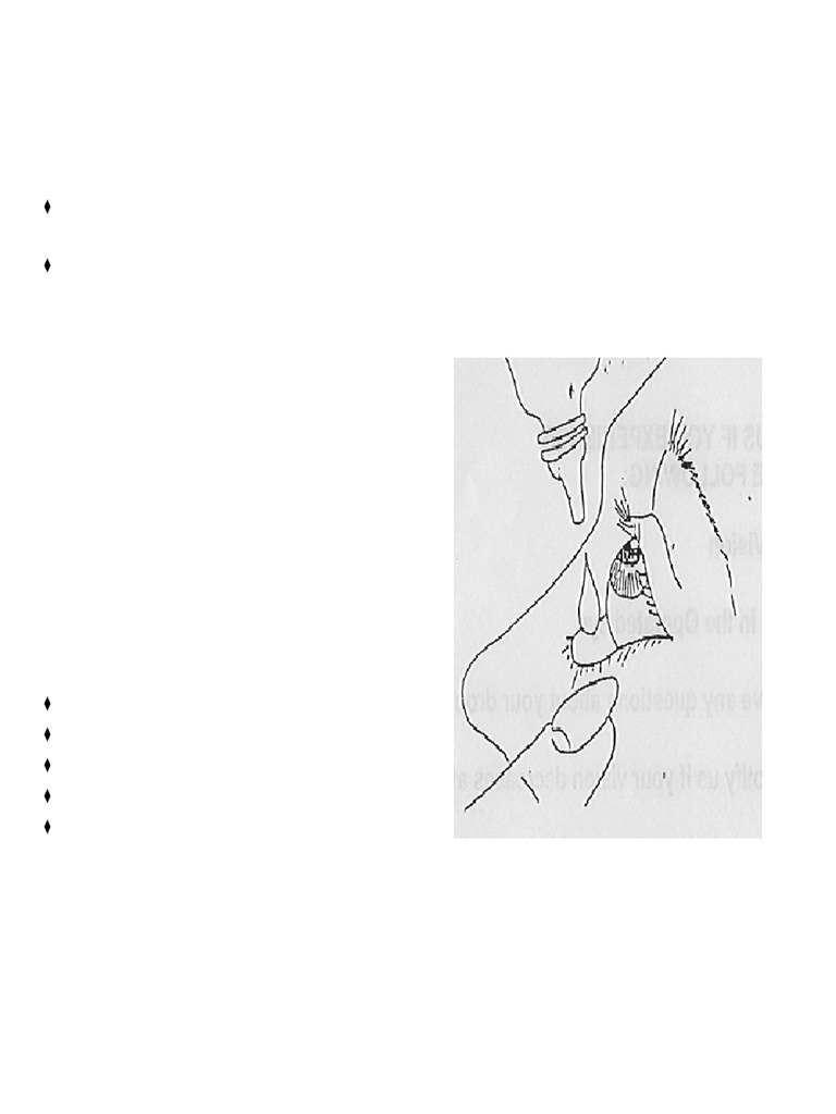 Discharge Instructions - Intravitreal Injection | PDF | Vision ...