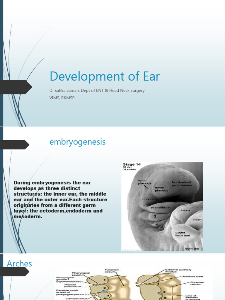Developmentofearppt 200505181546 | PDF | Ear | Otorhinolaryngology