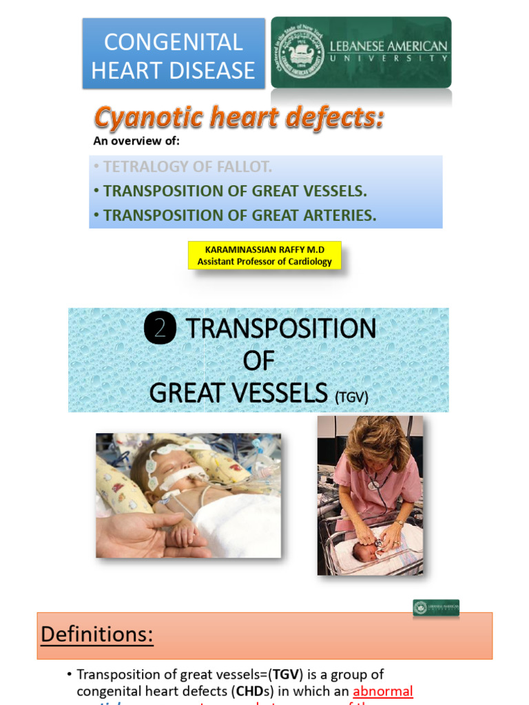 8-Transposition of Great Vessels (Light) | PDF | Internal Medicine ...