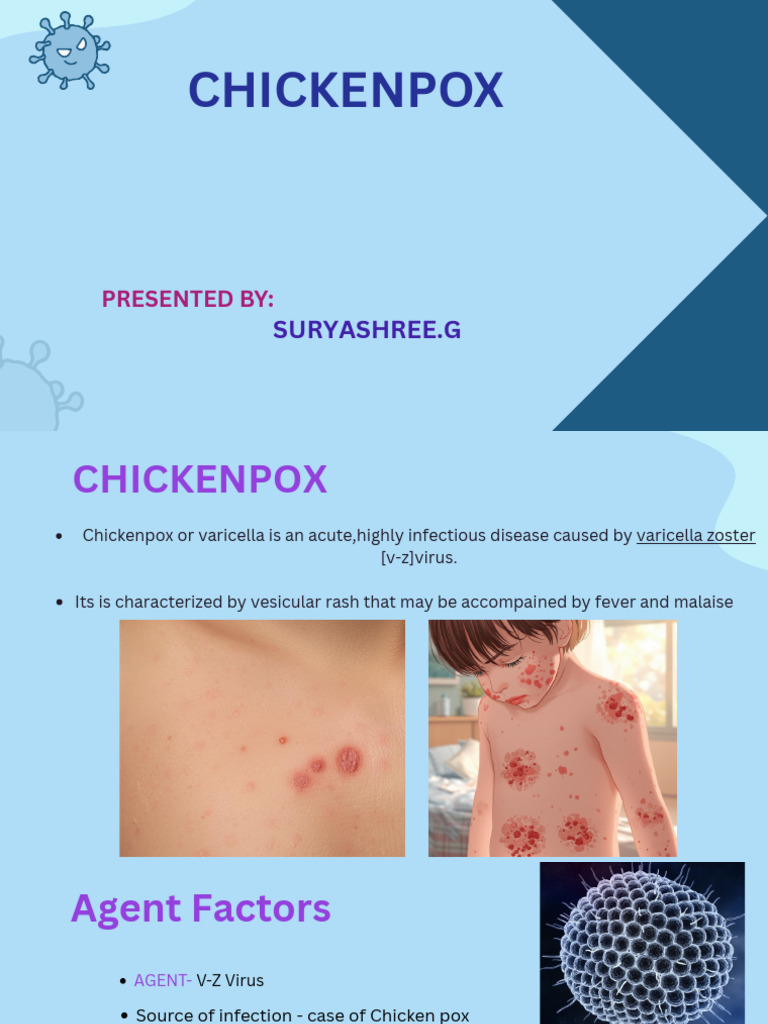 Chickenpox | PDF | Medical Specialties | Animal Diseases
