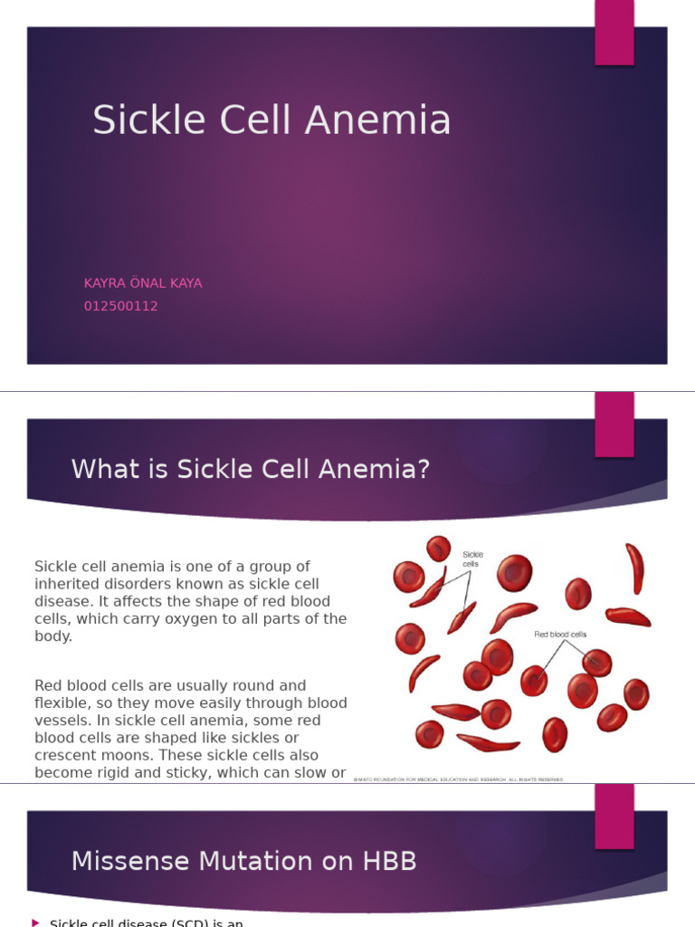 Sickle Cell Anemia | PDF | Hematopoietic Stem Cell Transplantation | Anemia