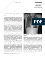 Articulo Pilates Medico 7 - Spontaneous Diaphragmatic Rupture Complicated With Perforation of The Stomach During Pilates