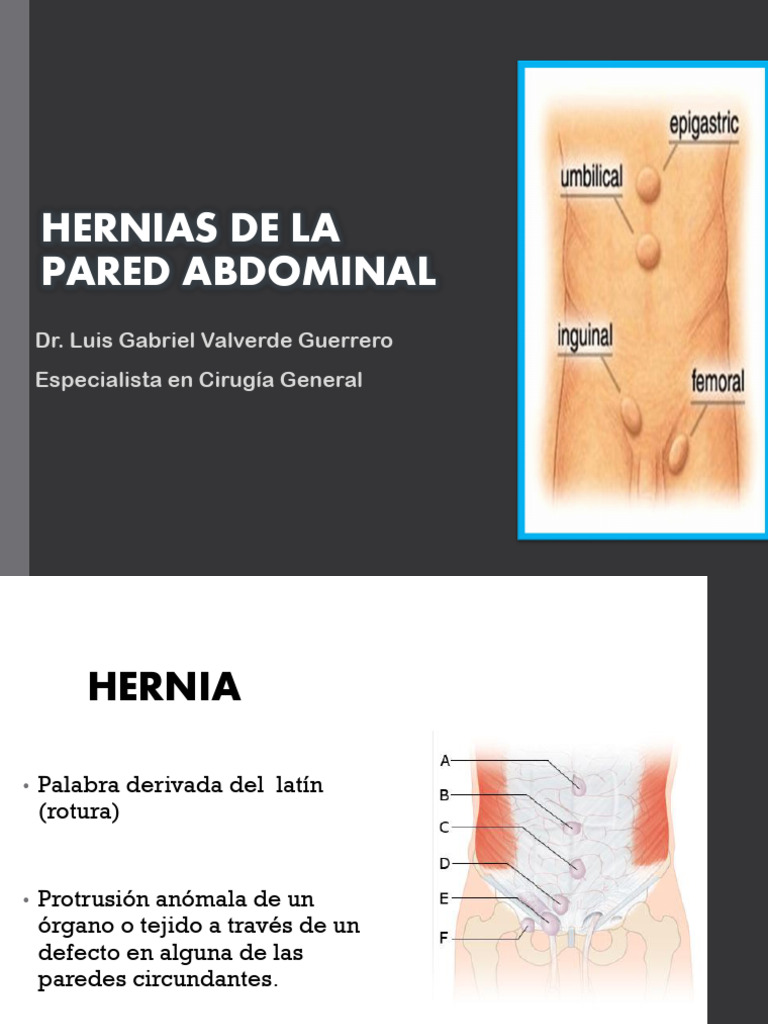 Hernias de La Pared Abdominal Dr Valverde (2) | PDF | Abdomen | Músculo