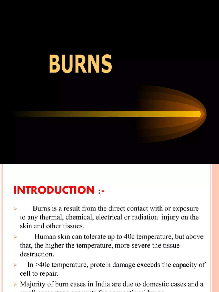Burns Final Ppt23 | PDF