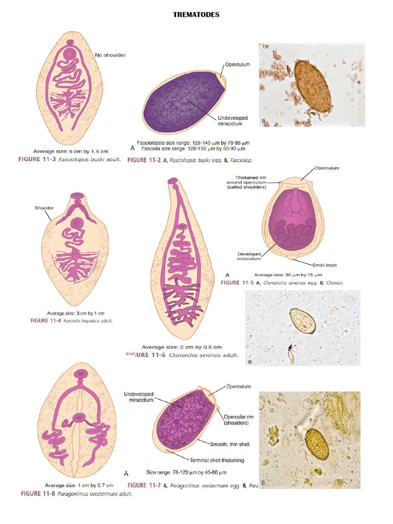 Trematodes Egg | PDF