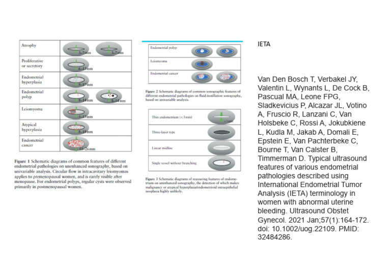 International Endometrial Tumor Analysis IETA | PDF
