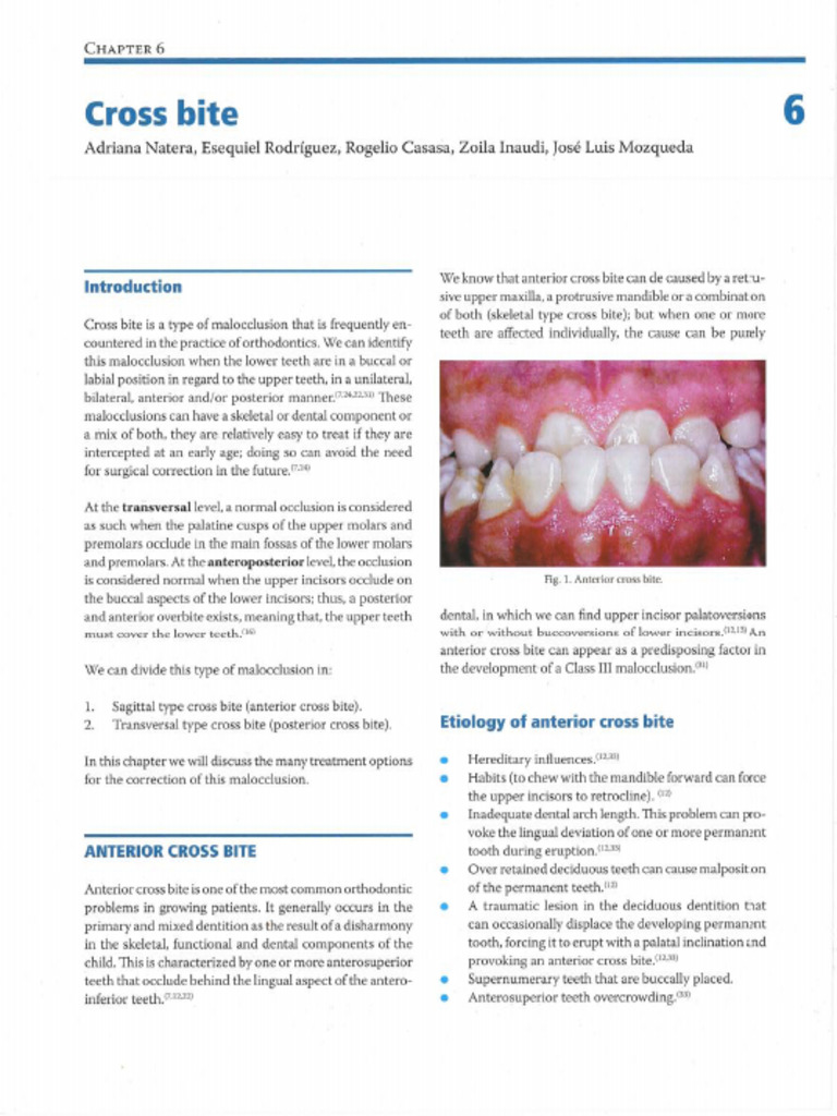 Chapter 6-Cross Bite | PDF | Dental Anatomy | Face
