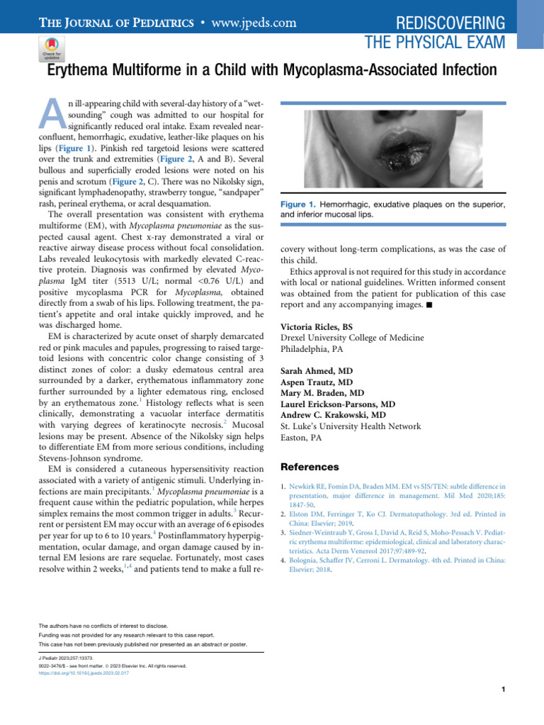 Erythema Multiforme in A Child With Mycoplasma Ass | PDF | Diseases And ...
