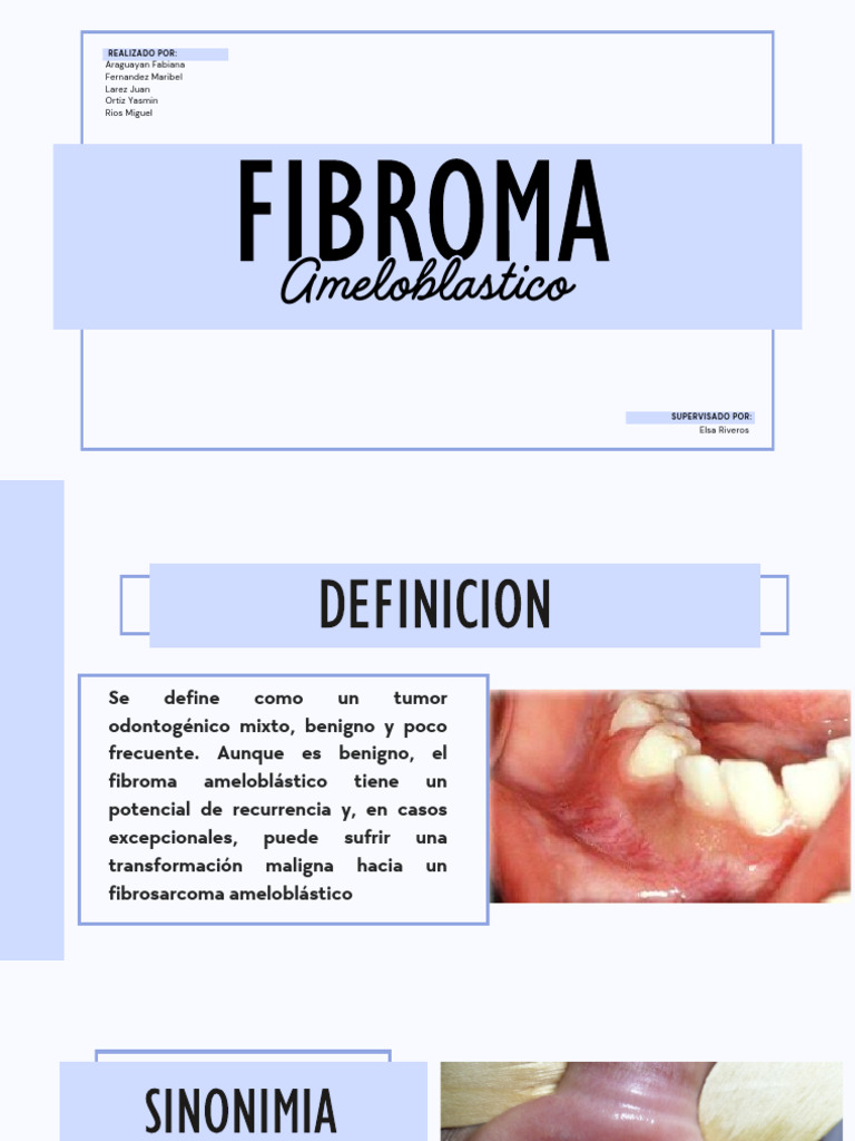 Fibroma Ameloblastico | PDF | Especialidades Medicas | Anatomía