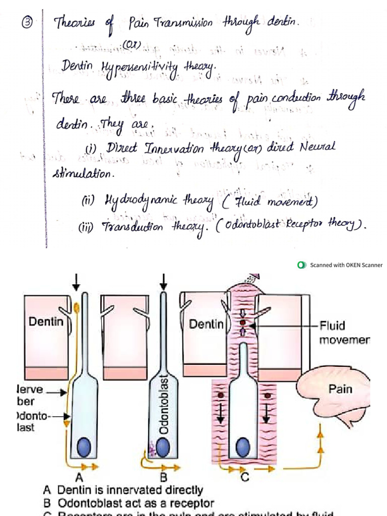 Theories of Dentin Hyper Sensitivity | PDF