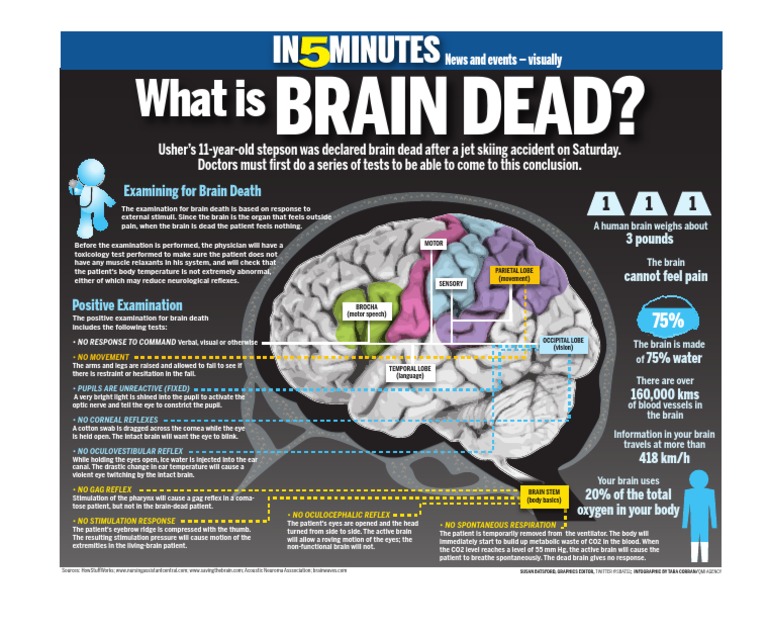 What Is Brain Dead? | PDF | Cornea | Brain