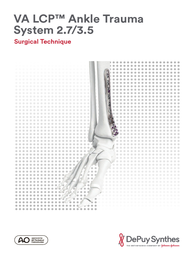 Synthes Catalogue Ankle System | PDF | Screw | Drill