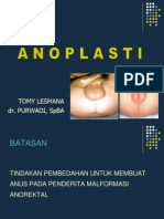 Anoplasty