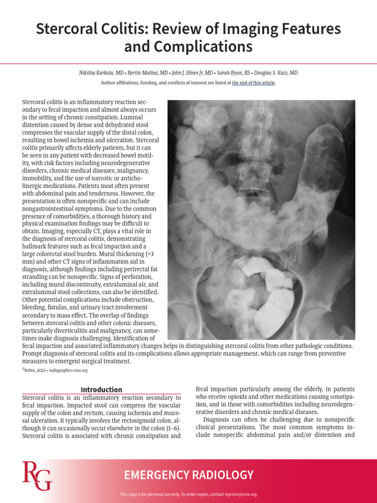 Karkala Et Al 2025 Stercoral Colitis Review of Imaging Features and ...