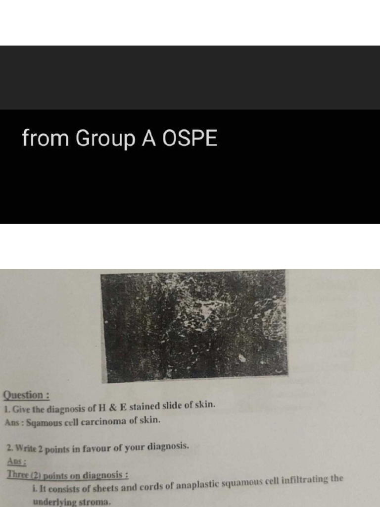 Pathology OSPE+ Practical | PDF