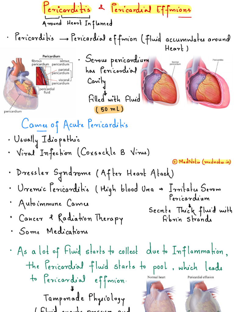 Pericarditis - Pericardial Effusions | PDF | Heart | Diseases And Disorders