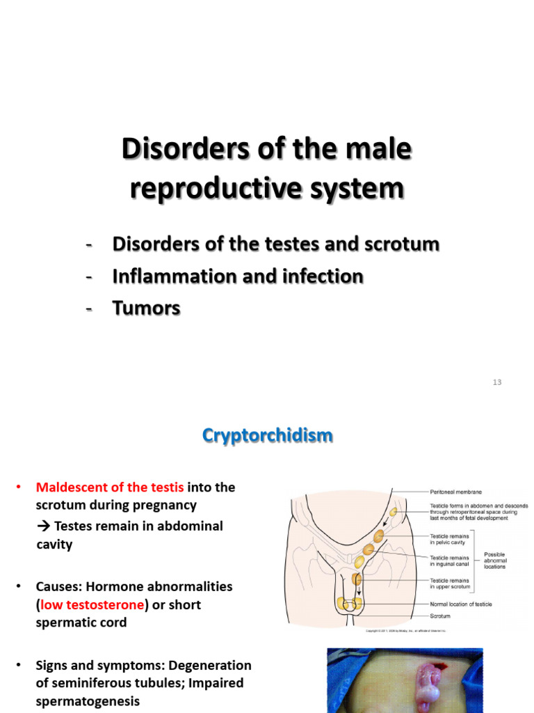 APP Chapter 5 Reproductive System Disorders 3 | PDF | Ovary | Menstrual ...