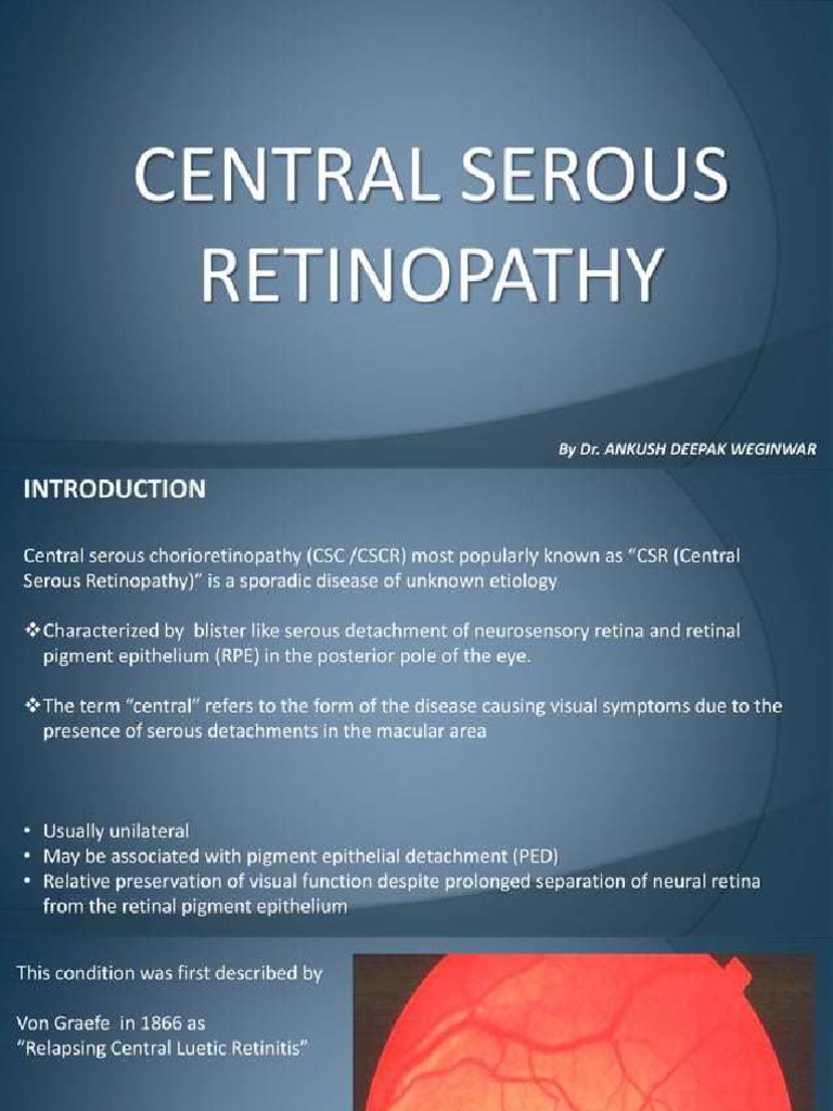 Central Serous Retinopathy | PDF