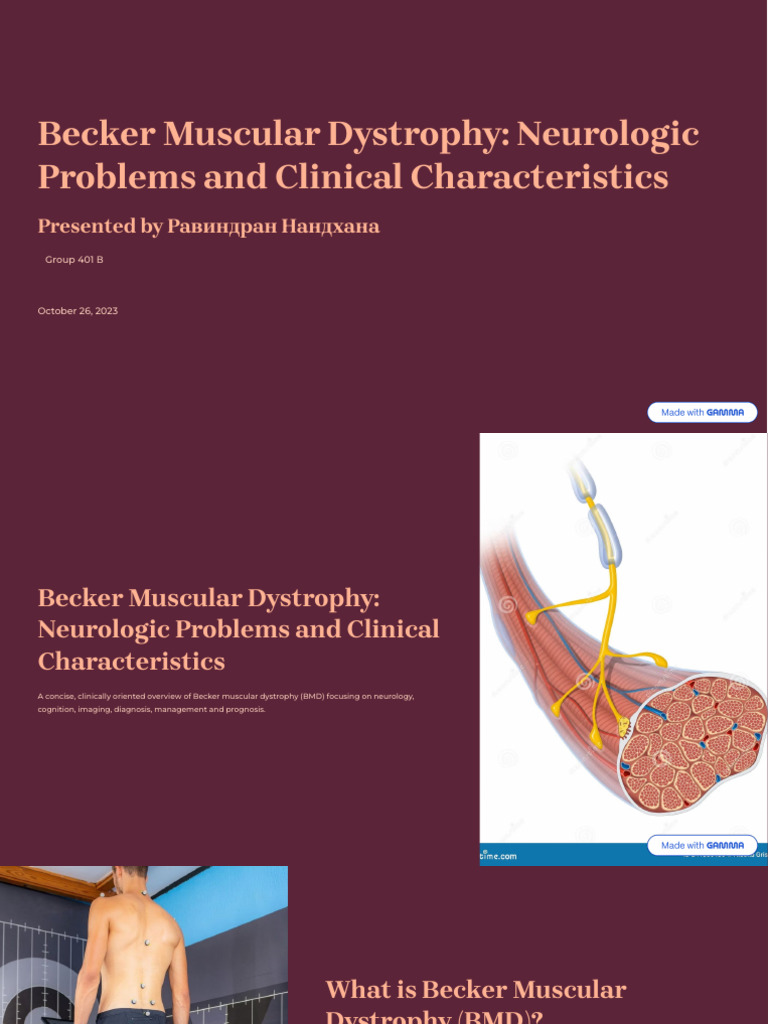 Becker Muscular Dystrophy Neurologic Problems and Clinical ...