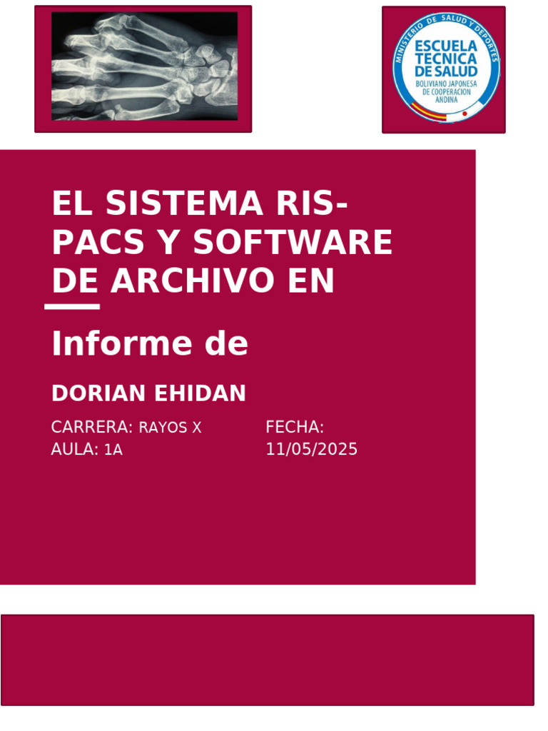 Investigacion Ris Pac | PDF | Imagenes medicas | Ct Scan