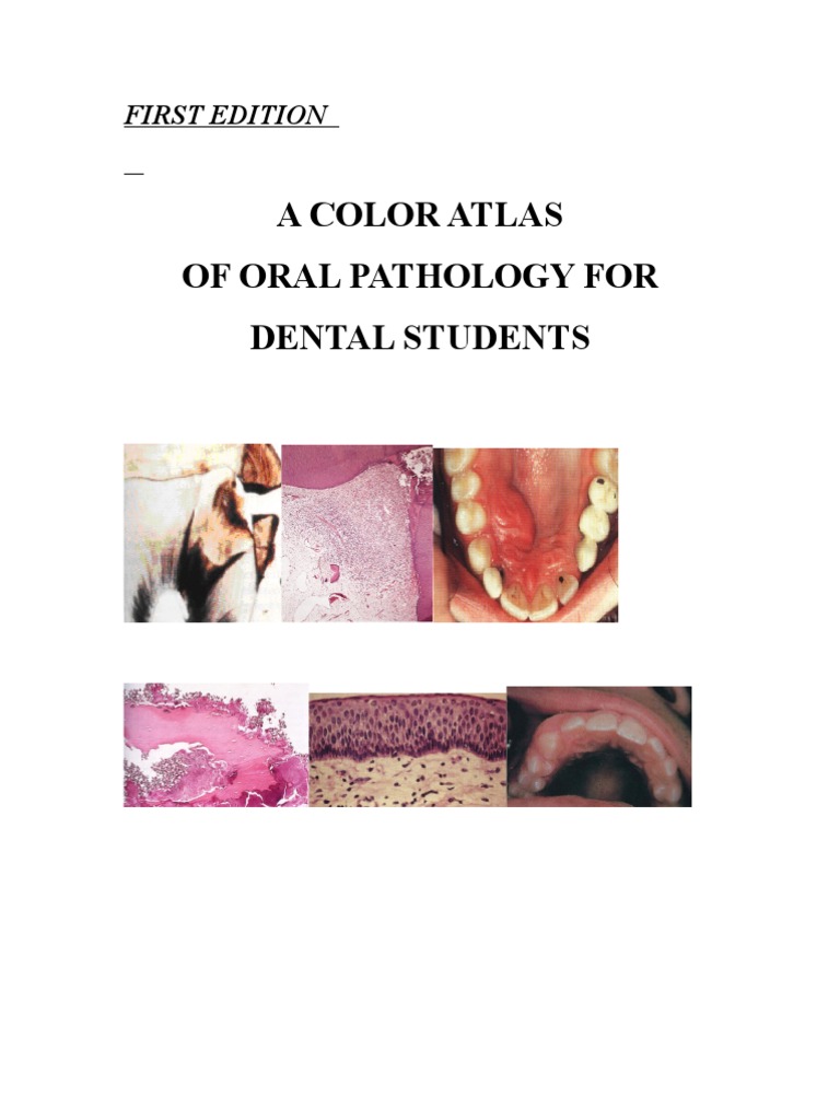 A Color Atlas For Oral Pathology | PDF