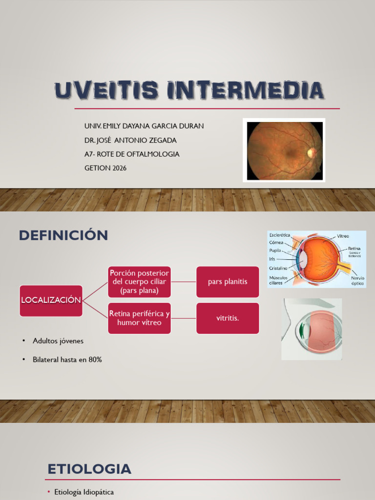 Uveitis Intermedia | PDF