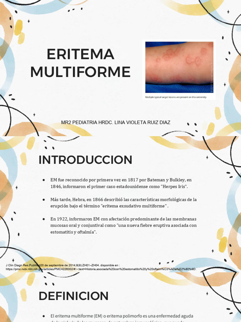 Eritema Multiforme | PDF | Corticosteroides | Especialidades Medicas