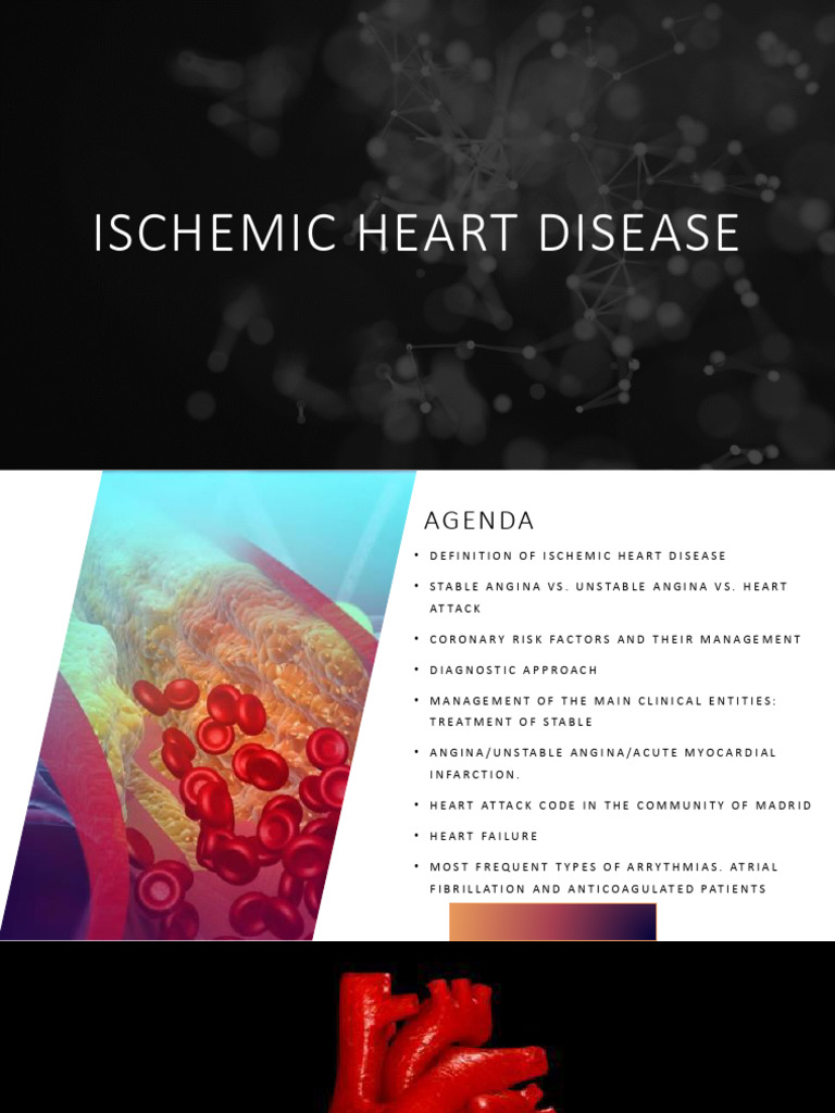 Ischemic Heart Disease | PDF | Myocardial Infarction | Heart