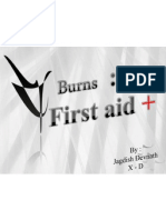First  Aid On Burns
